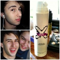 X Out treatment before and after